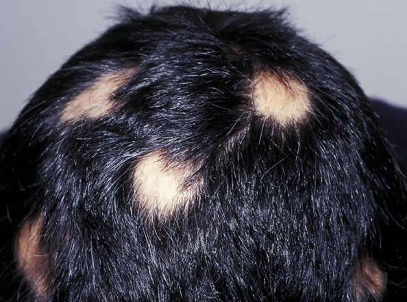 Scalp Itch In One Spot