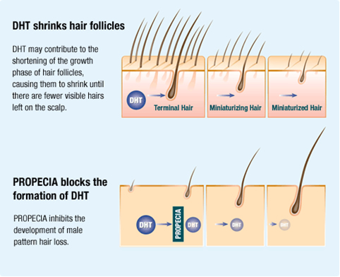 The Intense Psychological Effect of Hair Loss for Women1