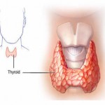 thyroid3