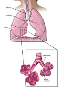 Are Emphysema and Bronchiectasis Reversible?