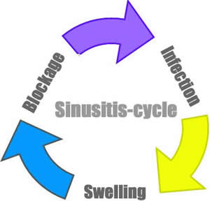 sinusitis-cycle