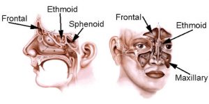 Sinus Infection Spreads to Brain Symptoms - Page 3