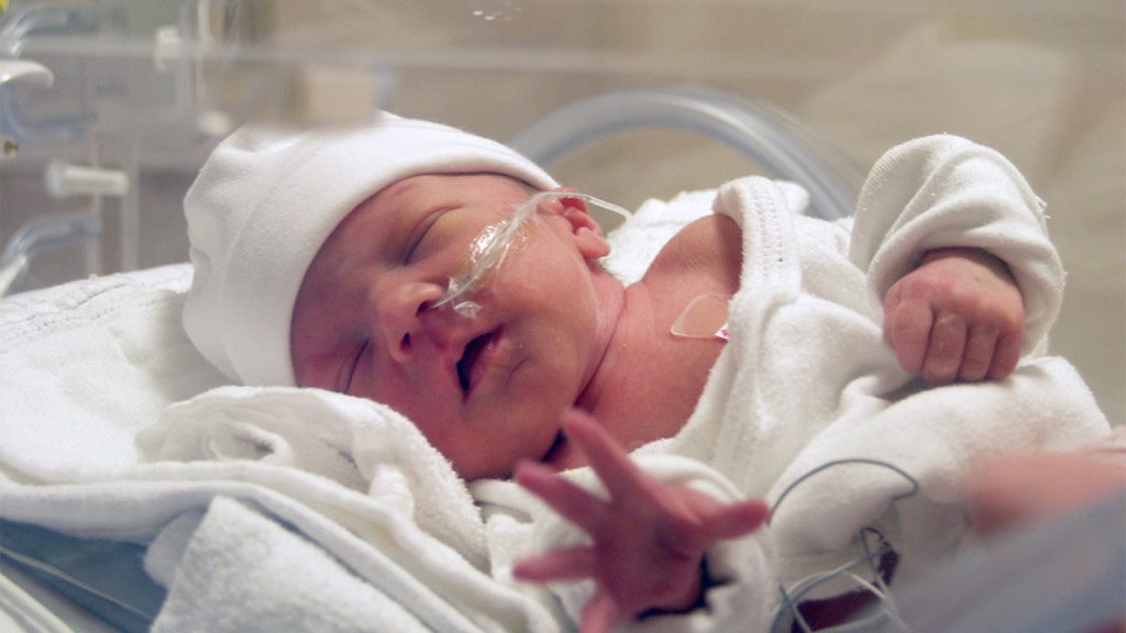 Everything You Need to Know About Premature Birth