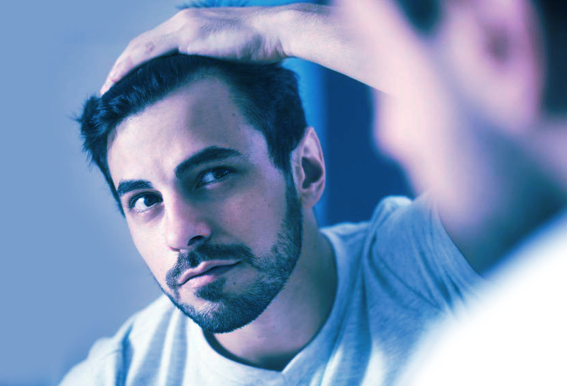 6 Best Hair Loss Treatment For Men